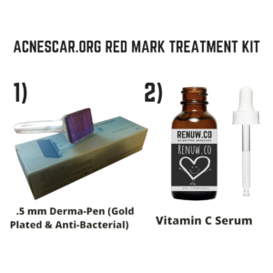 red acne scar treatment