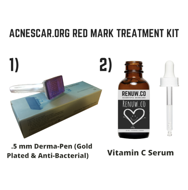 red acne scar treatment